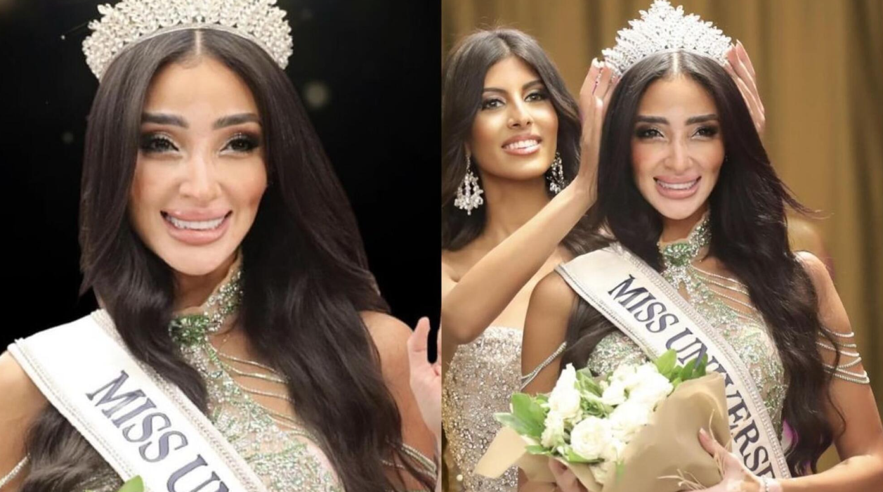 logina-salah-kontestan-miss-universe-2024-dari-mesir-yang-bangga-menampilkan-vitiligo-dan-lupus